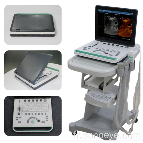 Scanner à ultrasons pour ordinateur portable 3D